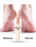 WEIMEI Rechargeable Electric Foot File Callus Remover for Wet & Dry Pedicure (DZ18555)